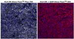 HLA-DR Antibody in Immunohistochemistry (Paraffin) (IHC (P))