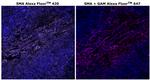 Alpha-Smooth Muscle Actin Antibody in Immunohistochemistry (Paraffin) (IHC (P))