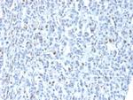 ZNF232 (Transcription Factor) Antibody in Immunohistochemistry (Paraffin) (IHC (P))