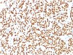 PAX8 Antibody in Immunohistochemistry (Paraffin) (IHC (P))