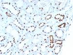 PAX8 (Renal Cell Marker) Antibody in Immunohistochemistry (Paraffin) (IHC (P))