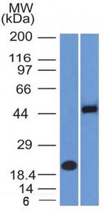 PAX8 (Renal Cell Marker) Antibody in Western Blot (WB)