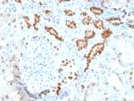 PAX8 (Renal Cell Marker) Antibody in Immunohistochemistry (Paraffin) (IHC (P))