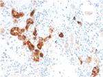 Calbindin 1 (CALB1) Antibody in Immunohistochemistry (Paraffin) (IHC (P))