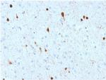 Calretinin/Calbindin 2 Antibody in Immunohistochemistry (Paraffin) (IHC (P))