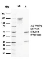 Calretinin/Calbindin 2 Antibody in SDS-PAGE (SDS-PAGE)