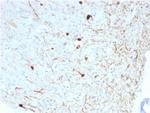 Calretinin/Calbindin 2 (Mesothelioma Marker) Antibody in Immunohistochemistry (Paraffin) (IHC (P))