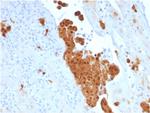 Calretinin/Calbindin 2 (Mesothelioma Marker) Antibody in Immunohistochemistry (Paraffin) (IHC (P))