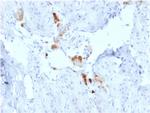 Calretinin/Calbindin 2 (Mesothelioma Marker) Antibody in Immunohistochemistry (Paraffin) (IHC (P))