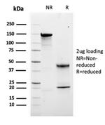 Calretinin/Calbindin 2 (Mesothelioma Marker) Antibody in SDS-PAGE (SDS-PAGE)