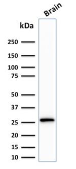 Calretinin/Calbindin 2 (Mesothelioma Marker) Antibody in Western Blot (WB)