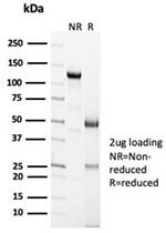 Calretinin/Calbindin 2 (Mesothelioma Marker) Antibody in SDS-PAGE (SDS-PAGE)