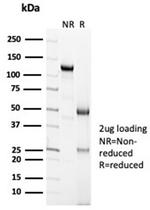 Calretinin/Calbindin 2 (Mesothelioma Marker) Antibody in Immunoelectrophoresis (IE)