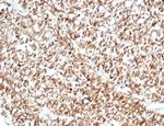 Calretinin/Calbindin 2 (Mesothelioma Marker) Antibody in Immunohistochemistry (Paraffin) (IHC (P))