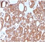 Calcitonin Antibody in Immunohistochemistry (Paraffin) (IHC (P))