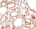 Calcitonin Antibody in Immunohistochemistry (Paraffin) (IHC (P))