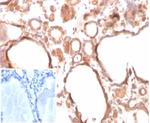 Calcitonin Antibody in Immunohistochemistry (Paraffin) (IHC (P))