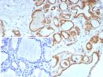 Calcitonin Antibody in Immunohistochemistry (Paraffin) (IHC (P))