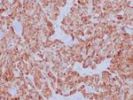 Calcitonin Antibody in Immunohistochemistry (Paraffin) (IHC (P))