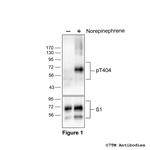 Phospho-beta-1-Adrenoceptor (Thr404) Antibody in Western Blot (WB)