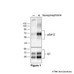 Phospho-beta-1-Adrenoceptor (Ser412) Antibody in Western Blot (WB)