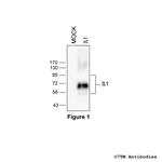 beta-1, beta-1-Adrenoceptor Antibody in Western Blot (WB)