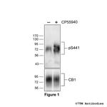 Phospho-Cannabinoid Receptor 1 (Ser441) Antibody in Western Blot (WB)