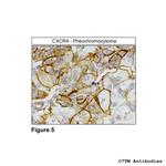 CXCR4, CXC Chemokine Receptor 4 Antibody in Immunohistochemistry (PFA fixed) (IHC (PFA))