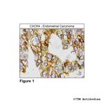 CXCR4, CXC Chemokine Receptor 4 Antibody in Immunohistochemistry (Paraffin) (IHC (P))