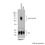 Phospho-Dopamine Receptor 2 (Ser317, Thr318) Antibody in Western Blot (WB)