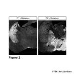 D2, Dopamine Receptor 2 Antibody in Immunohistochemistry (PFA fixed) (IHC (PFA))