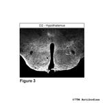 D2, Dopamine Receptor 2 Antibody in Immunohistochemistry (PFA fixed) (IHC (PFA))