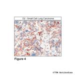 D2, Dopamine Receptor 2 Antibody in Immunohistochemistry (PFA fixed) (IHC (PFA))