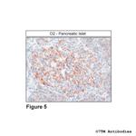 D2, Dopamine Receptor 2 Antibody in Immunohistochemistry (PFA fixed) (IHC (PFA))