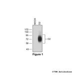 D2, Dopamine Receptor 2 Antibody in Western Blot (WB)