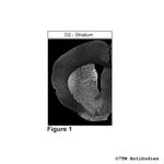 D2, Dopamine Receptor 2 Antibody in Immunohistochemistry (PFA fixed) (IHC (PFA))