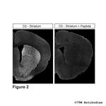 D2, Dopamine Receptor 2 Antibody in Immunohistochemistry (PFA fixed) (IHC (PFA))