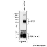 Phospho-Formylpeptide Receptor 2 (Thr335) Antibody in Western Blot (WB)