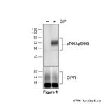 Phospho-Gastric Inhibitory Polypeptide Receptor (Thr442, Ser443) Antibody in Western Blot (WB)