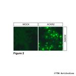 ACKR2, Atypical Chemokine Receptor 2 Antibody in Immunocytochemistry (ICC/IF)