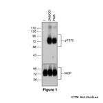 Phospho-mu-Opioid Receptor (Thr370) Antibody in Western Blot (WB)