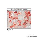 MOP, mu-Opioid Receptor Antibody in Immunohistochemistry (Paraffin) (IHC (P))