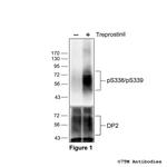 Phospho-DP2 Prostanoid Receptor (Ser338, Ser339) Antibody in Western Blot (WB)