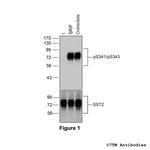 Phospho-Somatostatin Receptor 2 (Ser341, Ser343) Antibody in Western Blot (WB)