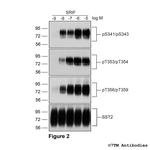 Phospho-Somatostatin Receptor 2 (Ser341, Ser343) Antibody in Western Blot (WB)