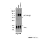 Phospho-Somatostatin Receptor 2 (Thr353, Thr354) Antibody in Western Blot (WB)