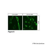 SST2, Somatostatin Receptor 2 Antibody in Immunocytochemistry (ICC/IF)