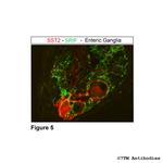 SST2, Somatostatin Receptor 2 Antibody in Immunocytochemistry (ICC/IF)