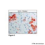 SST2, Somatostatin Receptor 2 Antibody in Immunohistochemistry (Paraffin) (IHC (P))