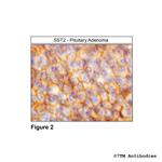 SST2, Somatostatin Receptor 2 Antibody in Immunohistochemistry (Paraffin) (IHC (P))